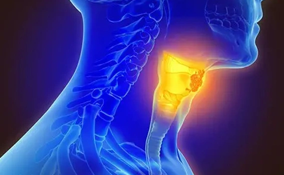 Pharyngeal Cancer Staging (TNM System)