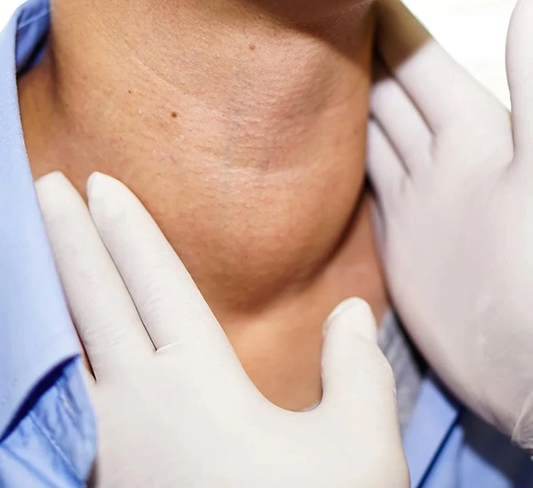 Thyroid Cancer Surgery Cost in Gurgaon